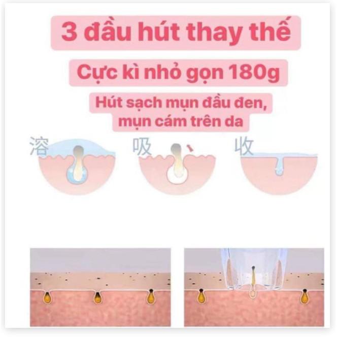 Hút mụn siêu hót