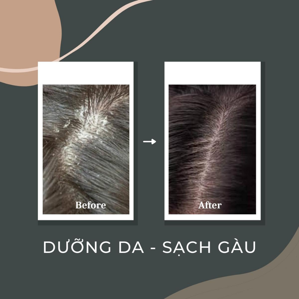 Lotion làm sạch gàu chăm sóc tóc DR. SOMCHAI ANTI-DANDRUFF giảm da đầu bong tróc và dưỡng ẩm da đầu 30ml