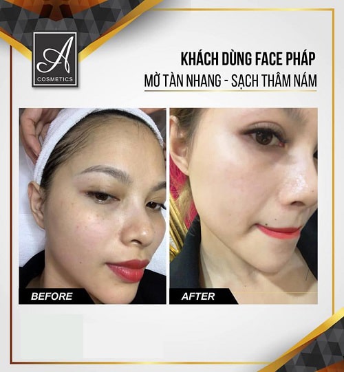 Kem Face Pháp 2021 Whitening Face Cream A Cosmetics