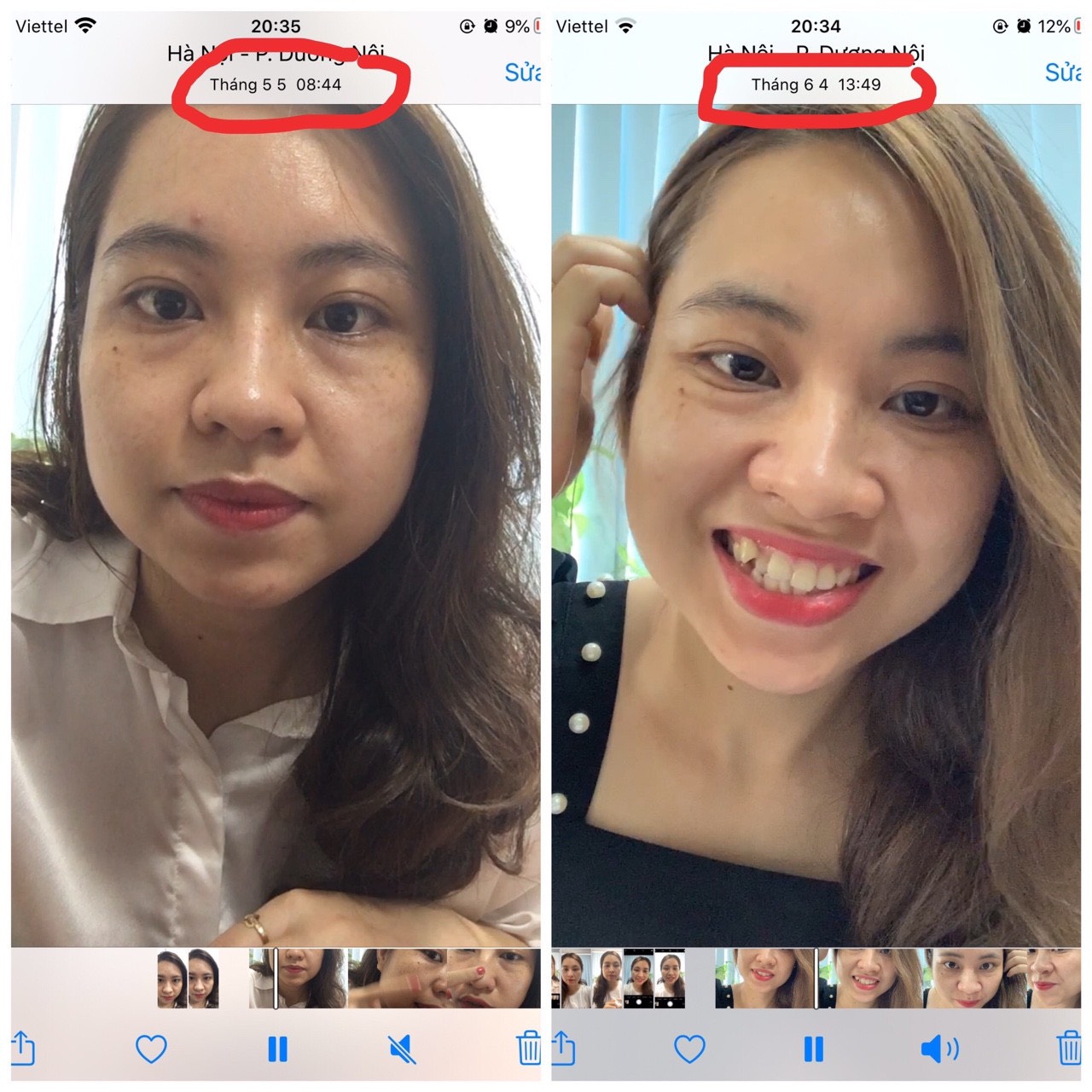 Viên uống trắng da, giảm sạm nám Prima Donna hỗ trợ đẹp da - hỗ trợ giảm sạm nám