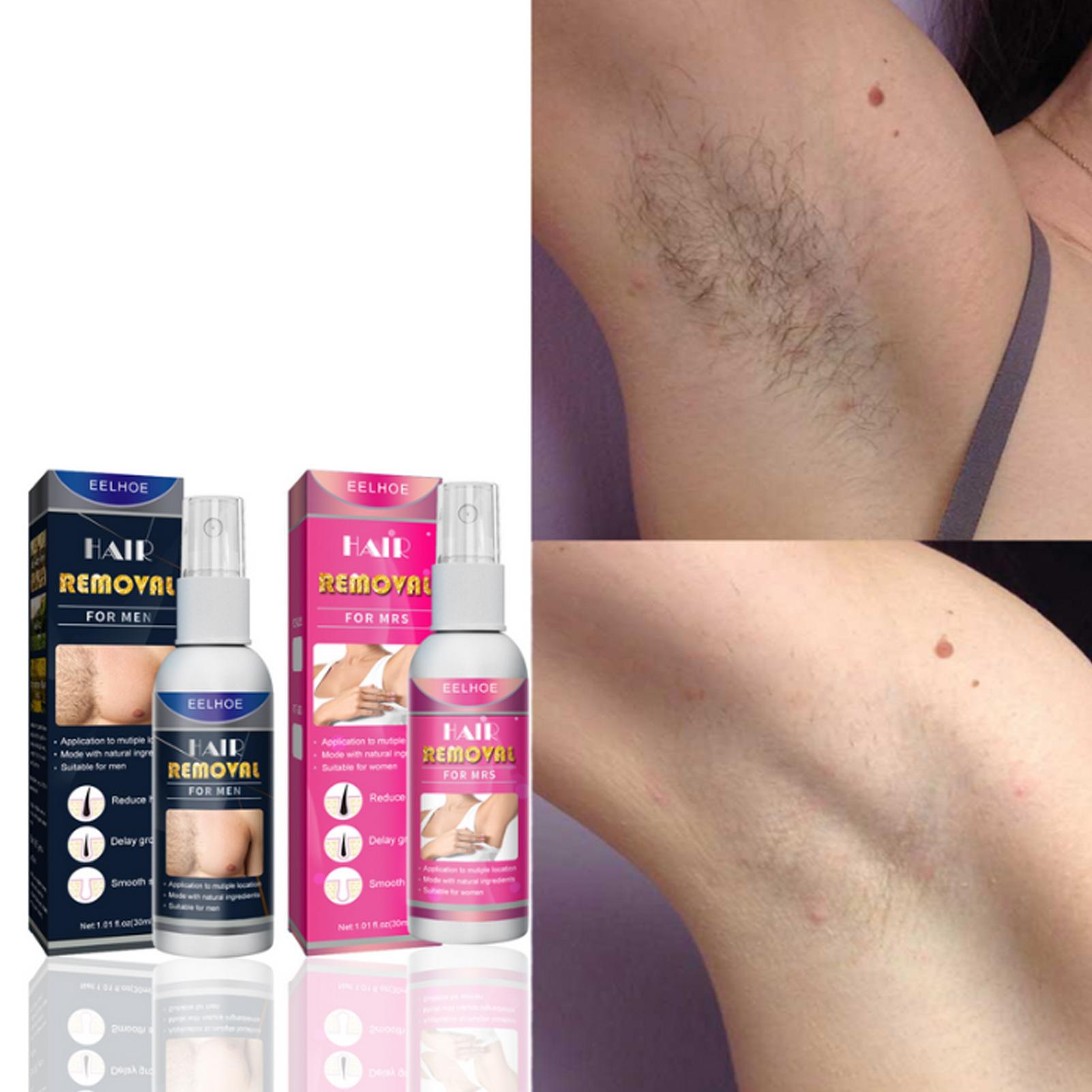 EELHOE 30ml Hair Removal Spray for Men Painless Hair Removal Spray Armpit Gentle Hair Remover Refreshing Quick Hair Removal Cream