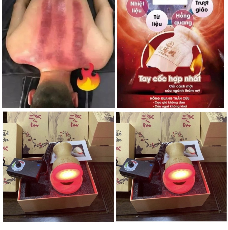 Dụng cụ massage cốc nhiệt hồng quang đả thông kinh lạc thư giãn dùng trong spa dưỡng sinh