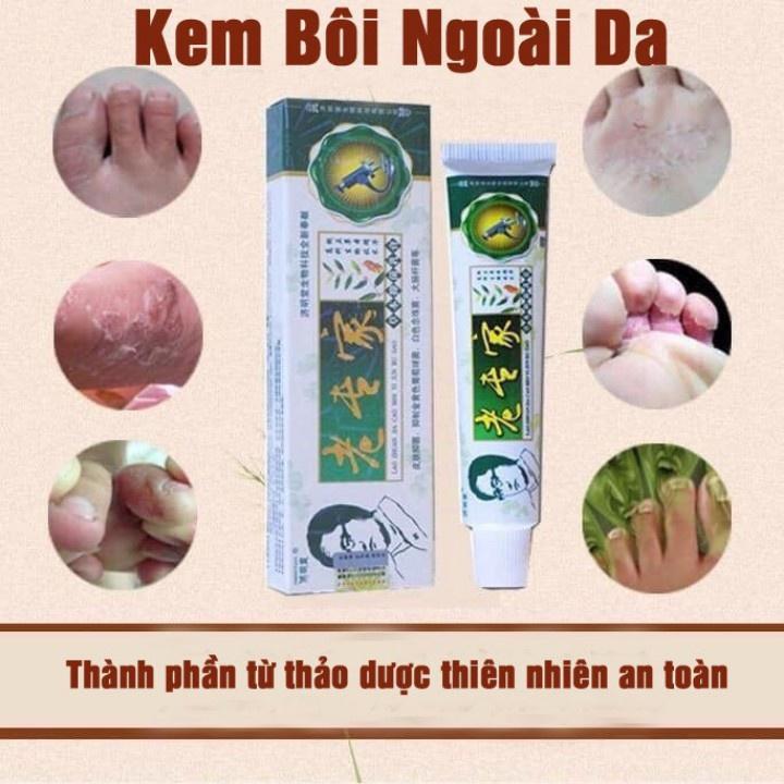 Kem Bôi Ngoài Da Vảy Nến, Á Sừng, Nấm Ngứa, Nứt Nẻ Hàng Nội Địa Trung Cao Cấp Tuýp 15g (XL)