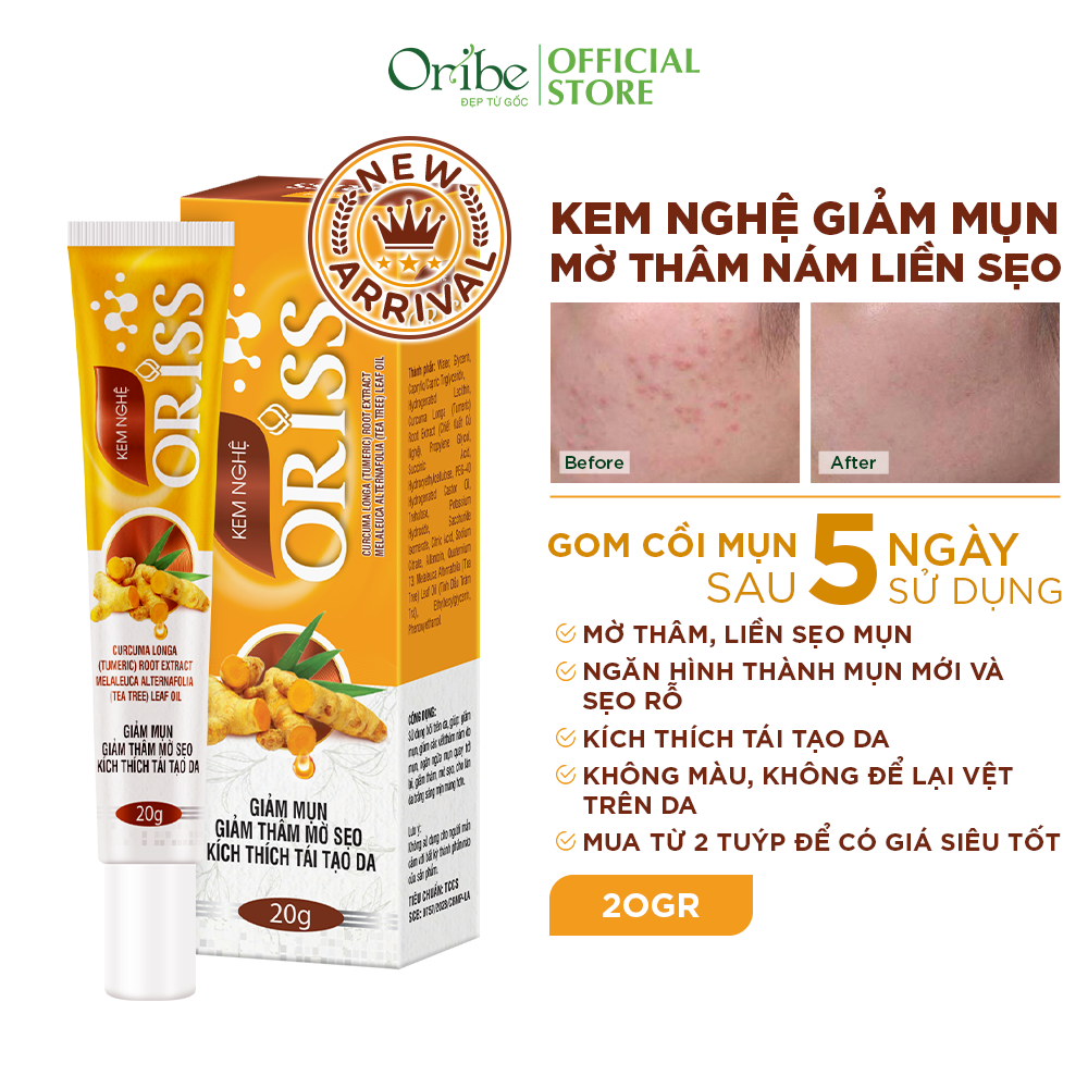 Kem Nghệ Giảm Mụn Mờ Thâm Liền Sẹo Kích Thích Tái Tạo Da Oriss Tuýp 20g