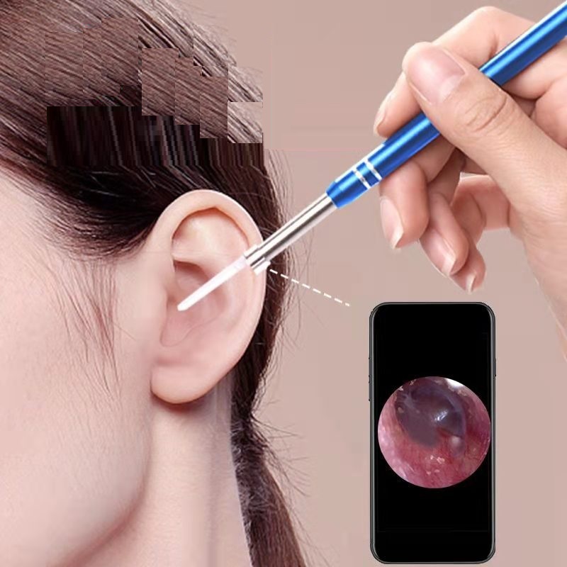 Bộ Lấy Ráy Tai Có Đèn, Camera Mini, Camera Nội Soi Tai, Mũi, Họng Siêu Nét Đi Kèm Bộ Đầu Lấy Ráy Tai, Soi Tai Mũi Họng Chuyên Nghiệp