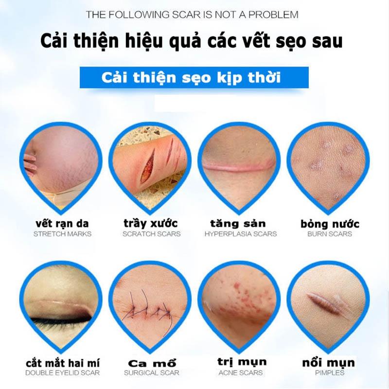 Kem xóa sẹo, loại bỏ hiệu quả các vết sẹo lâu năm, sẹo phẫu thuật, phục hồi và làm sáng các vết rạn da khi mang thai, xó