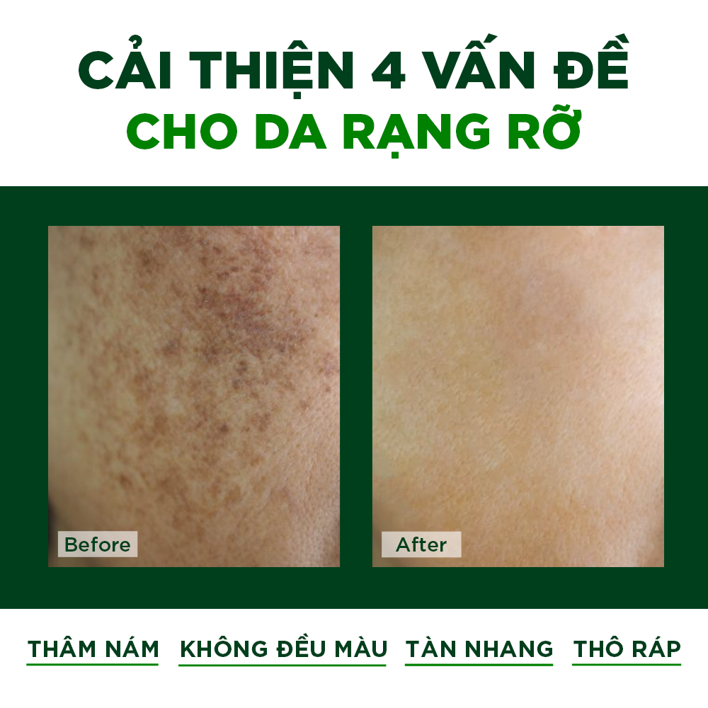 Serum Trắng Da Mờ Nám Tàn Nhang Chống Lão Hóa Oribe - Vi Tảo Lục và Tinh Dầu Thông Trắng Nhật Bản