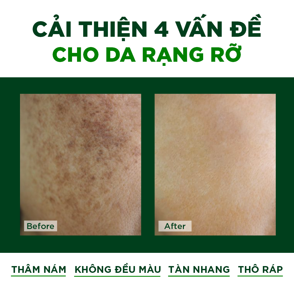 Serum Trắng Da Mờ Nám Tàn Nhang Chống Lão Hóa Oribe - Vi Tảo Lục và Tinh Dầu Thông Trắng Nhật Bản (Dạng Viên, Hộp 36 Viên)