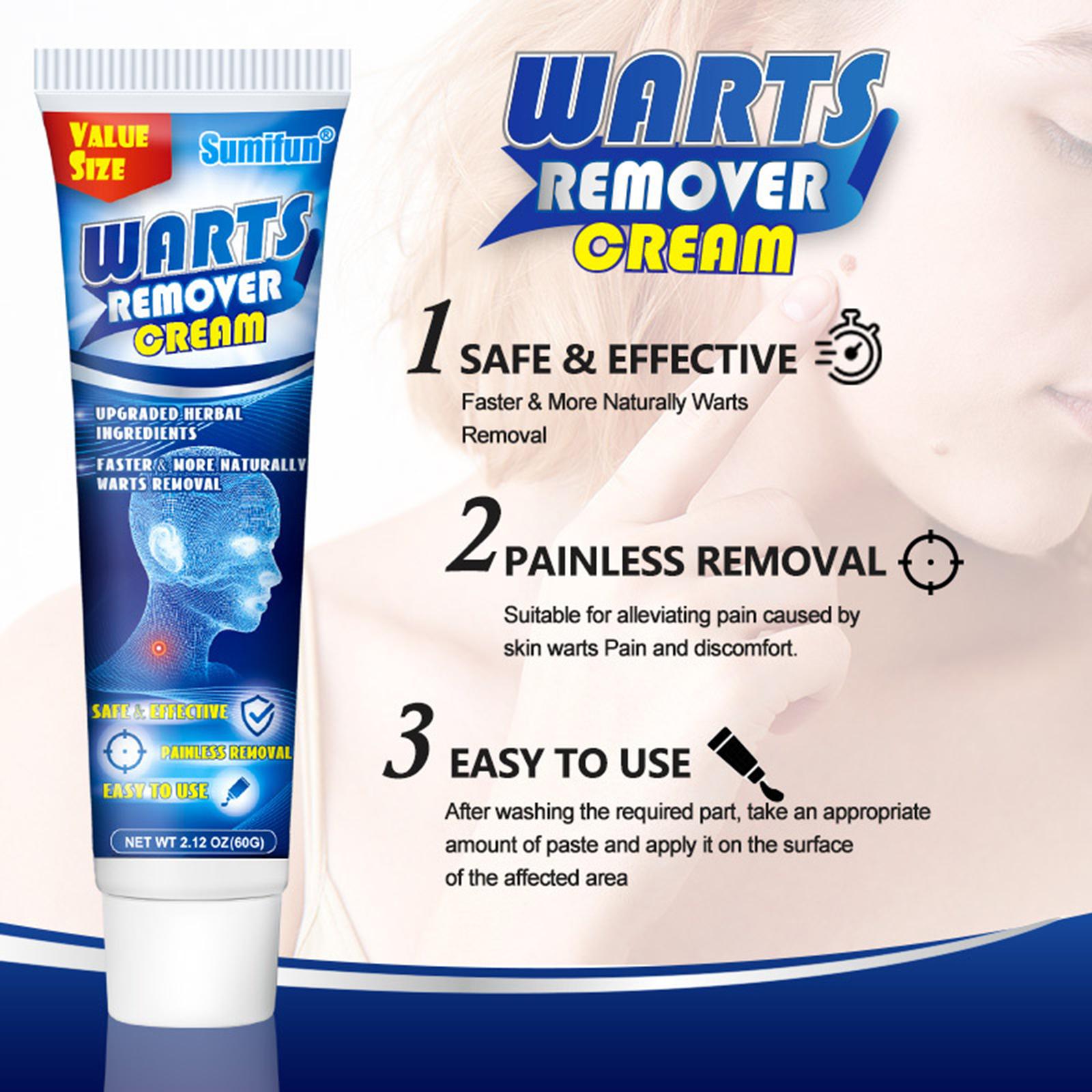 Wart soothing corns cream Ke wart cream
