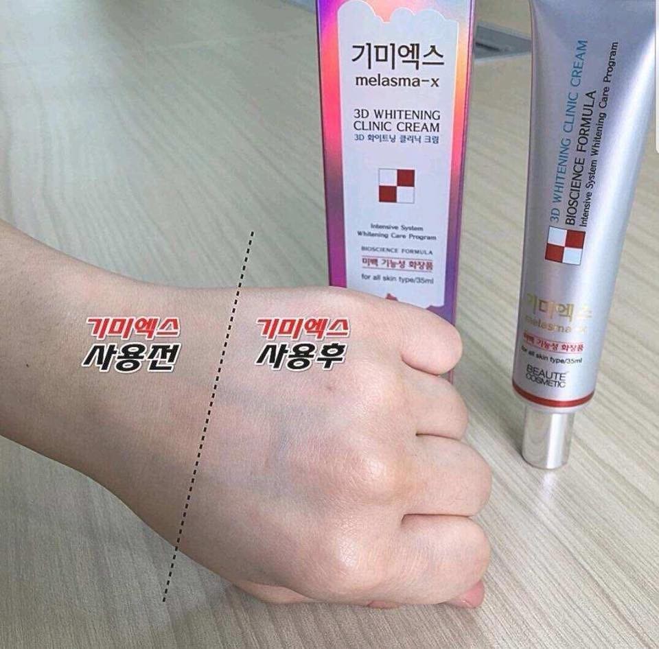 Kem Hỗ Trợ Giảm Thâm Nám Và Tàn Nhang Melasma-X 3D Whitening Clinic Cream