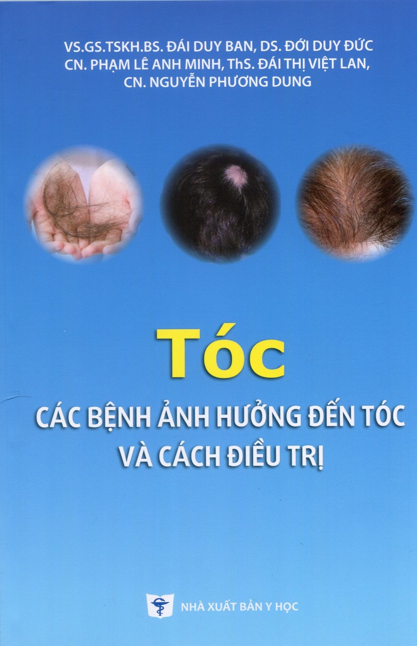 Tóc, Các Bệnh Ảnh Hưởng Đến Tóc Và Cách Điều Trị