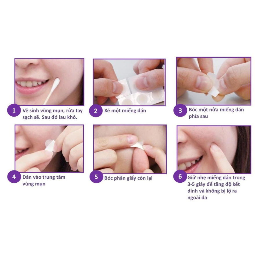 Combo 5 Miếng Dán hỗ trợ điều trị Mụn Mayancare 12 Miếng