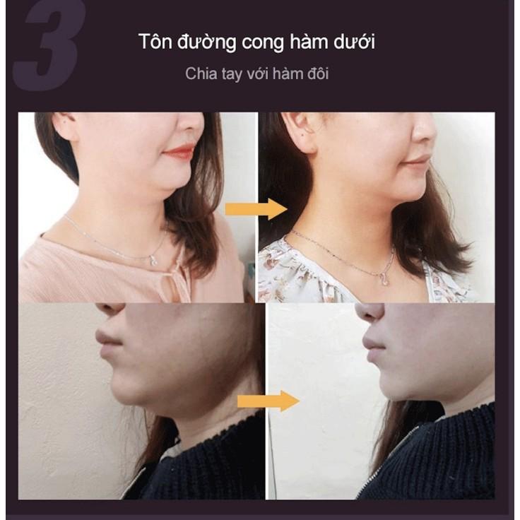 Dụng cụ làm thon gọn định hình khuôn mặt