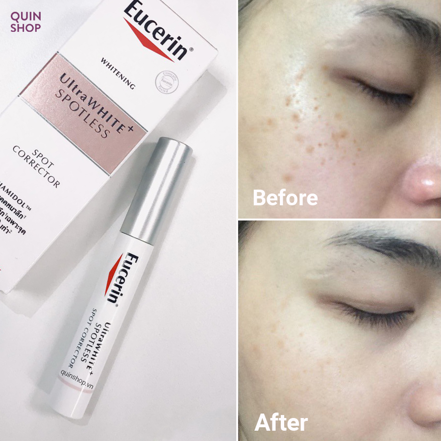 Tinh chất giảm thâm nám Eucerin Ultra White Spotless SPOT CORRECTOR 5ml