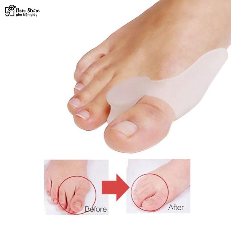 2 Miếng Gel Silicon Dụng Cụ Tách Ngón Chân Bunion Dụng Cụ Điều Chỉnh Chứng Vẹo Ngón Chân Chăm Sóc Bàn Chân #sil 28