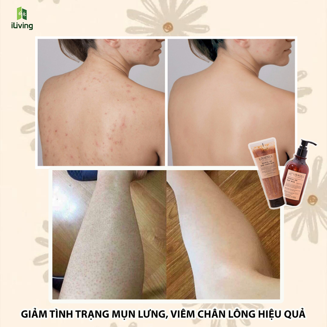 Bộ chăm sóc da body sữa tắm dưỡng thể Louv Cell 300ml và tẩy da chết body Louv Cell 230ml LOUTDCST