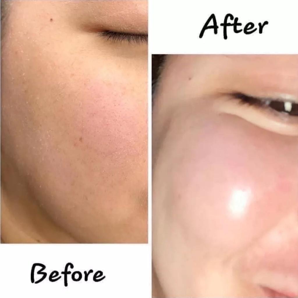 Kem phục hồi tái tạo da nhạy cảm Martiderm Skin Repair Cicra Vass Cream