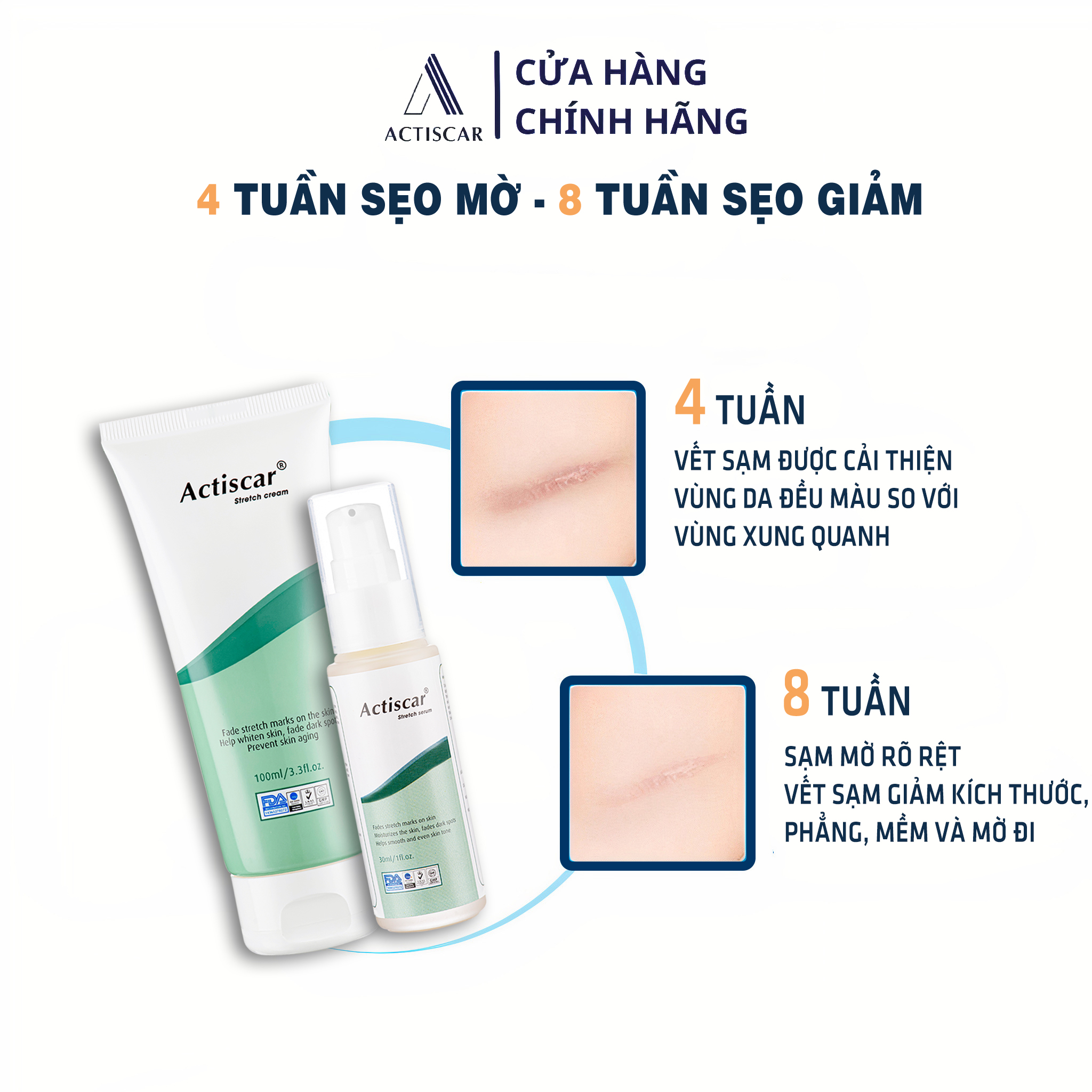 Combo Kem Rạn Da Actiscar Stretch 100ml và Serum Rạn Da 30ml