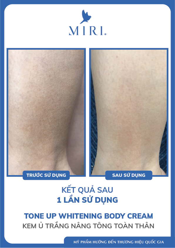 KEM Ủ TRẮNG NÂNG TÔNG TOÀN THÂN - TONE UP WHITENING BODY CREAM MIRI 