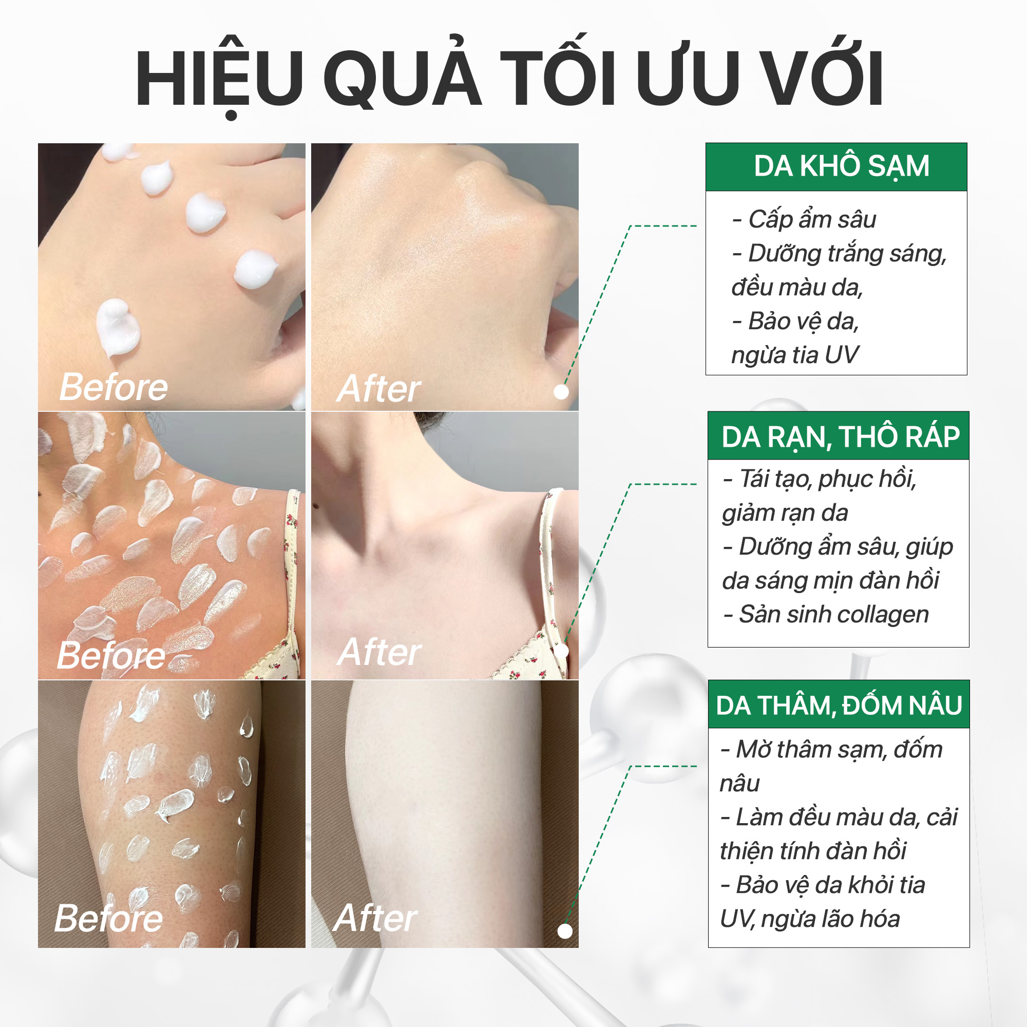 KEM BODY DƯỠNG TRẮNG MỊN DA RAU MÁ, NÂNG TONE TỨC THÌ, MỜ SẠM, THẨM THẤU NHANH - Centella Healthy White Body Cream GUO