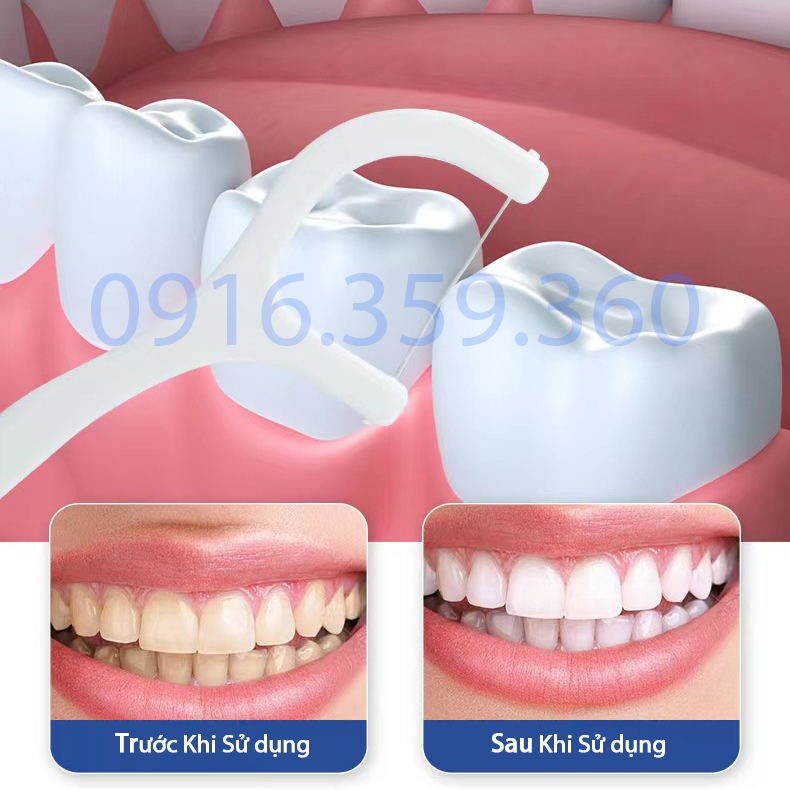 Bộ 100 Tăm Chỉ Nha Khoa Tròn Dùng Một Lần