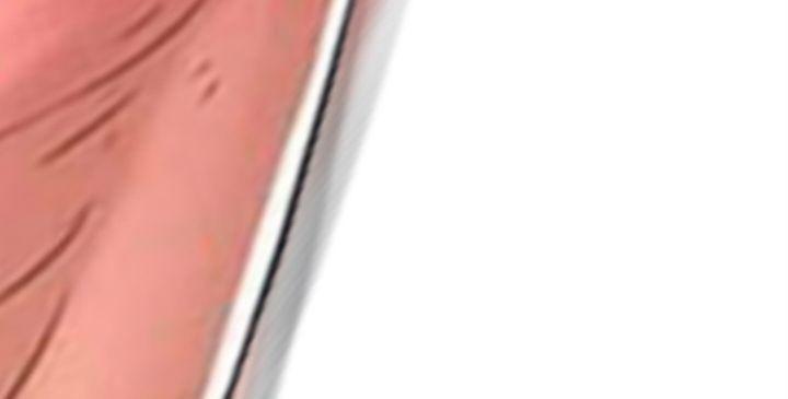 ts vildred [sr] chapter 35.2 4