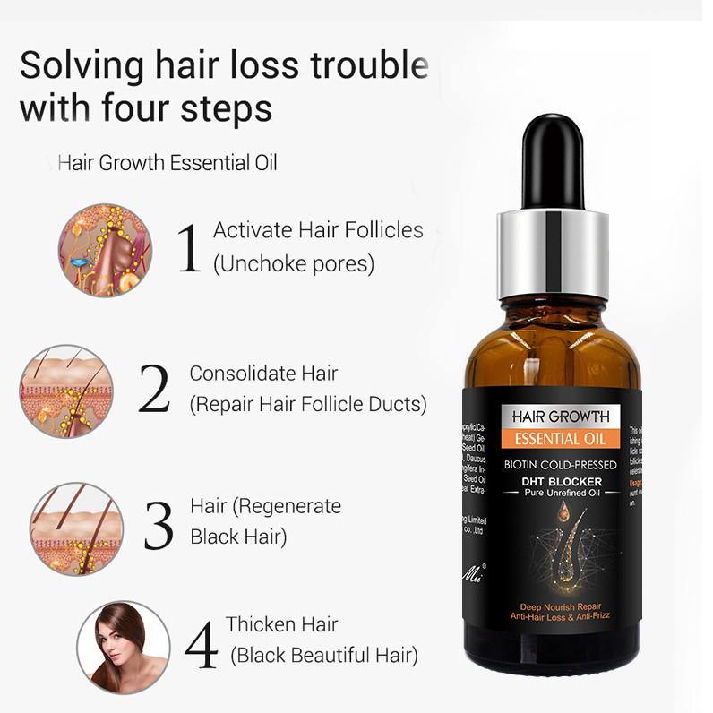 Tinh dầu gừng dưỡng tóc Hair Growth Essential Oil 30ml