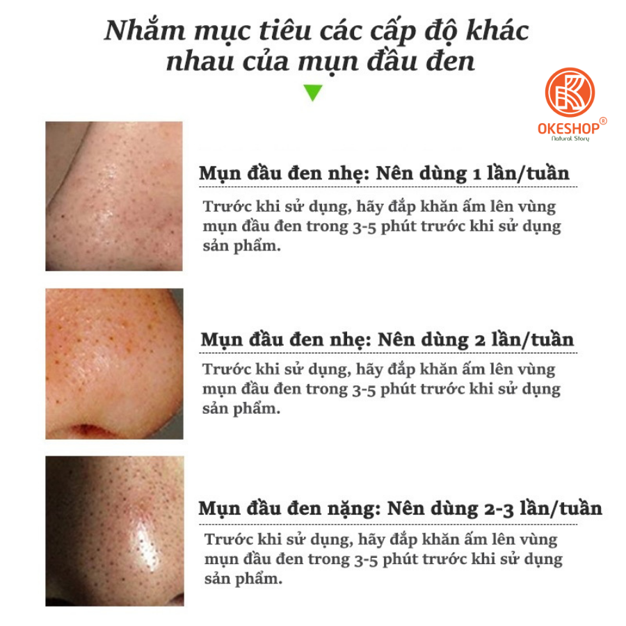 Gel Lột Mụn OKESHOP 30ml - Giải Pháp Loại Bỏ Mụn Đầu Đen - Mụn Cám - Bạ Nhờn - Làm Sạch Sâu Và Thu Nhỏ Lỗ Chân Lông