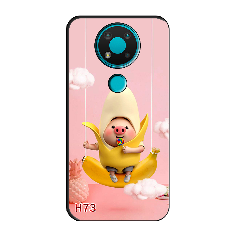 Ốp Dẻo Dành Cho NOKIA 3.4