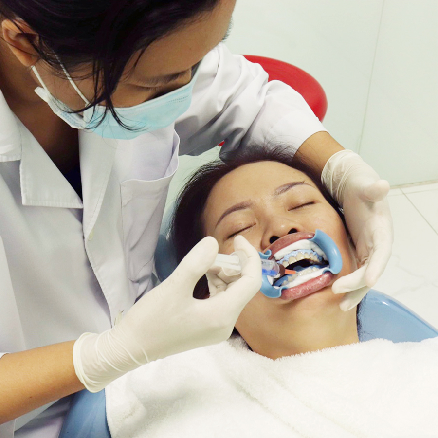 Hình ảnh Dịch Vụ Tẩy Trắng Răng Tại Nhà - Nha Khoa Hạnh Nguyên