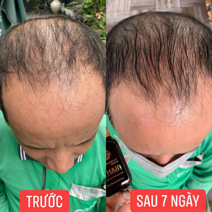 Tinh chất dài mi, mọc tóc Dr Hair Zenpali chính hãng