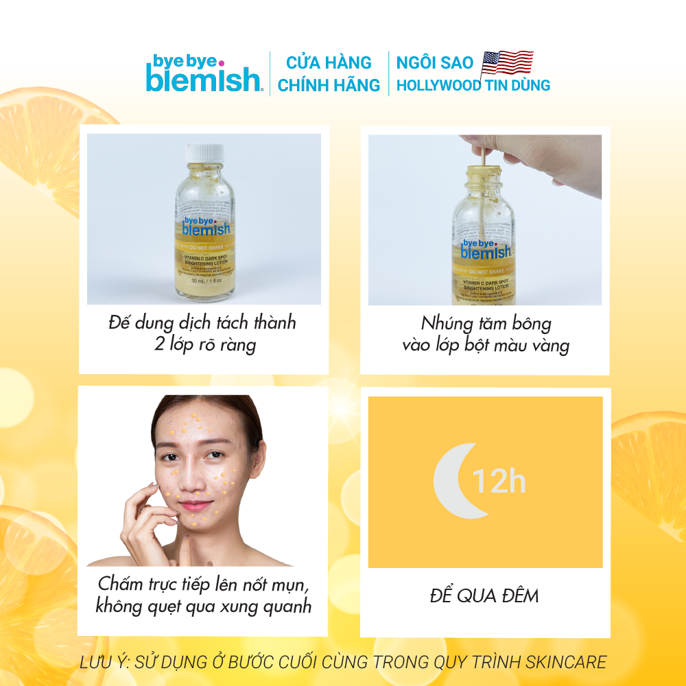 Chấm mụn Bye Bye Blemish Drying Lotion 30ml giảm mụn nhanh sau 1 đêm cho tất cả loại mụn trên mặt và body