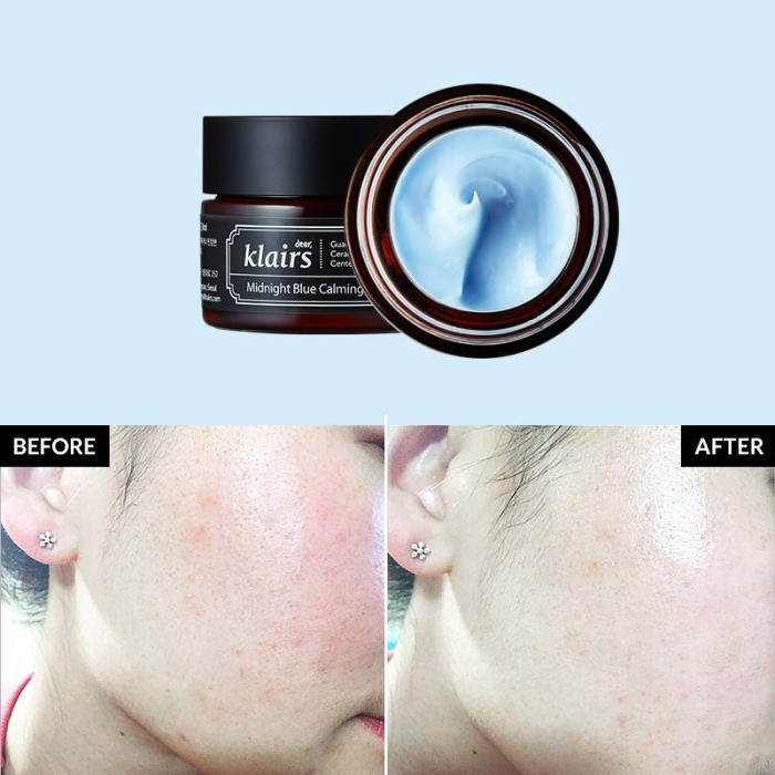 Kem Dưỡng Ẩm Klairs Làm Dịu Và Phục Hồi Da Ban Đêm Midnight Blue Calming Cream