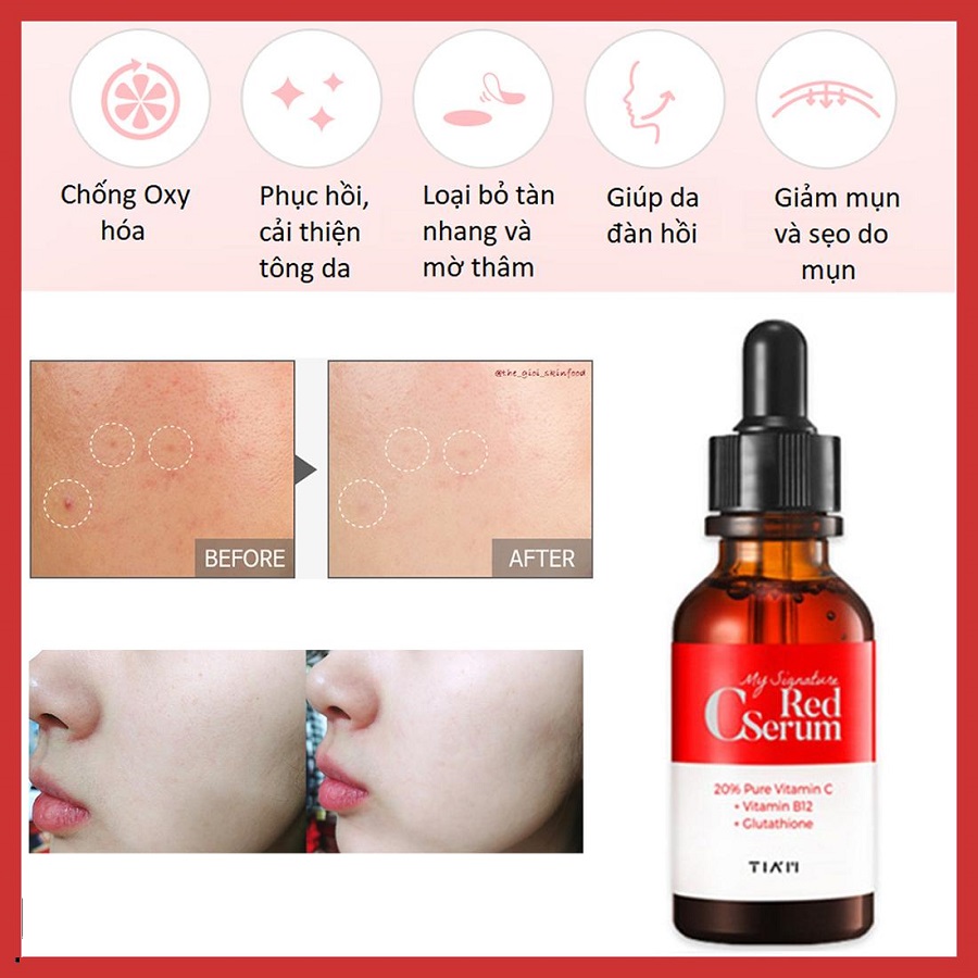 Tinh Chất Phục Hồi Dưỡng Trắng Sáng Da TIAM My Signature Red C Serum 30ml