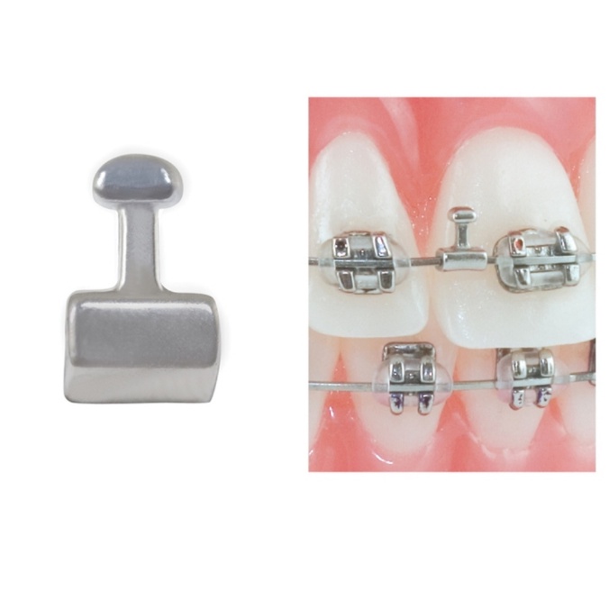 Hook 1.3mm_DTC _Dùng trong nha khoa_Niềng răng_Chỉnh nha
