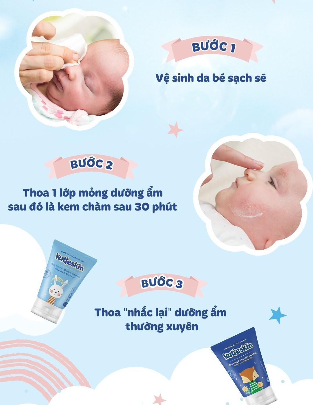 Combo kem chàm sữa và kem dưỡng ẩm kutieskin 30gr