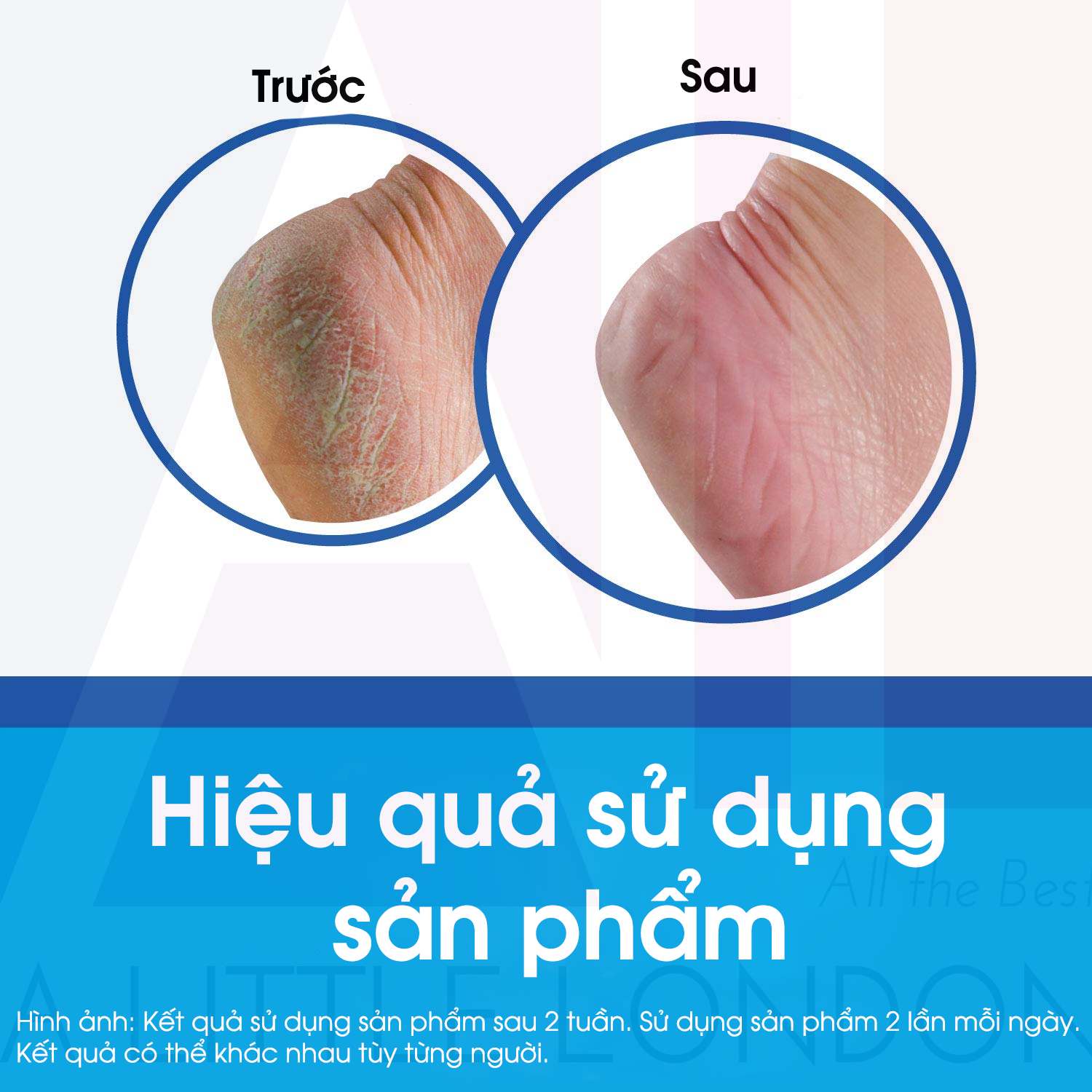 Kem dưỡng phuc hồi da chân khô, nứt nẻ O’Keeffe’s Healthy Feet Cream 91g