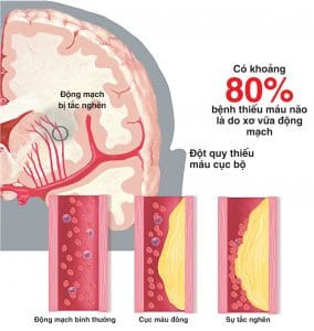 super brain & heart