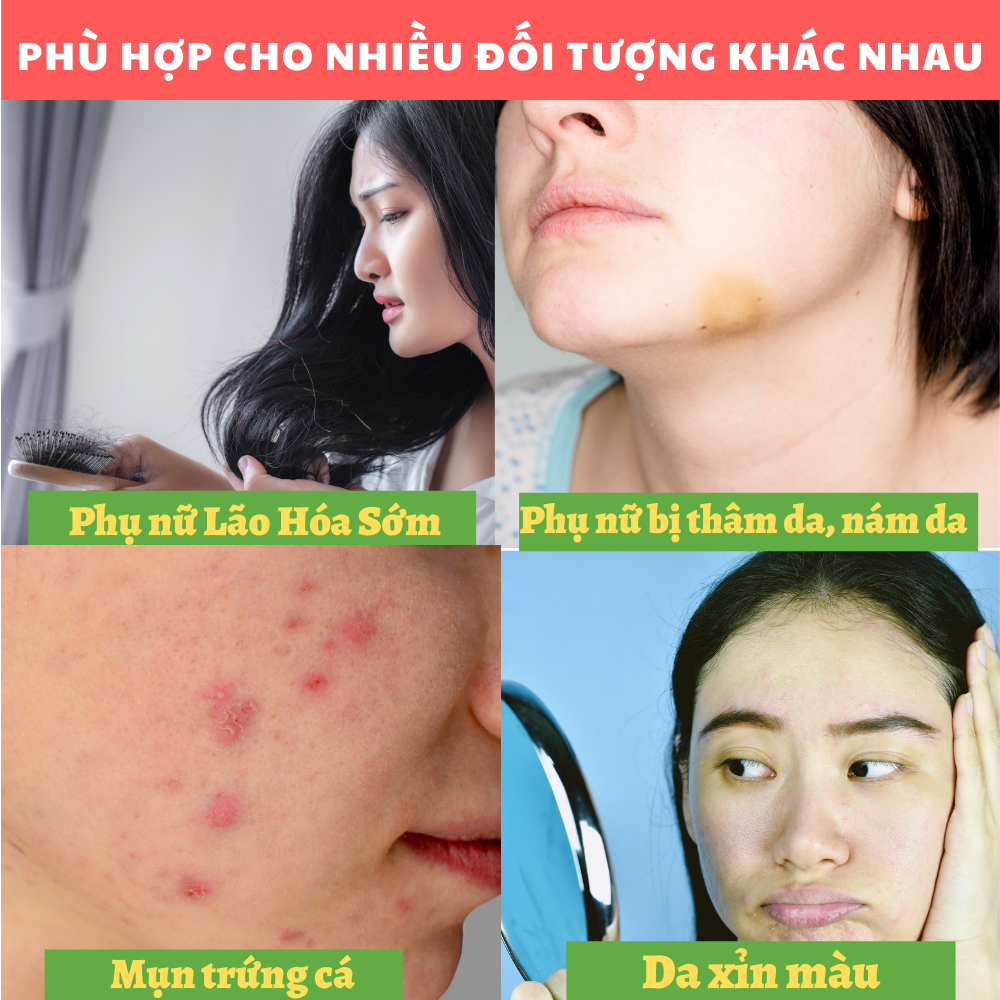 Collagen Royal Jelly - Ngăn ngừa quá trình lão hóa, Tăng cường độ đàn hồi cho da, Bảo vệ tế bào da, giúp da chắc khỏe, mịn màng