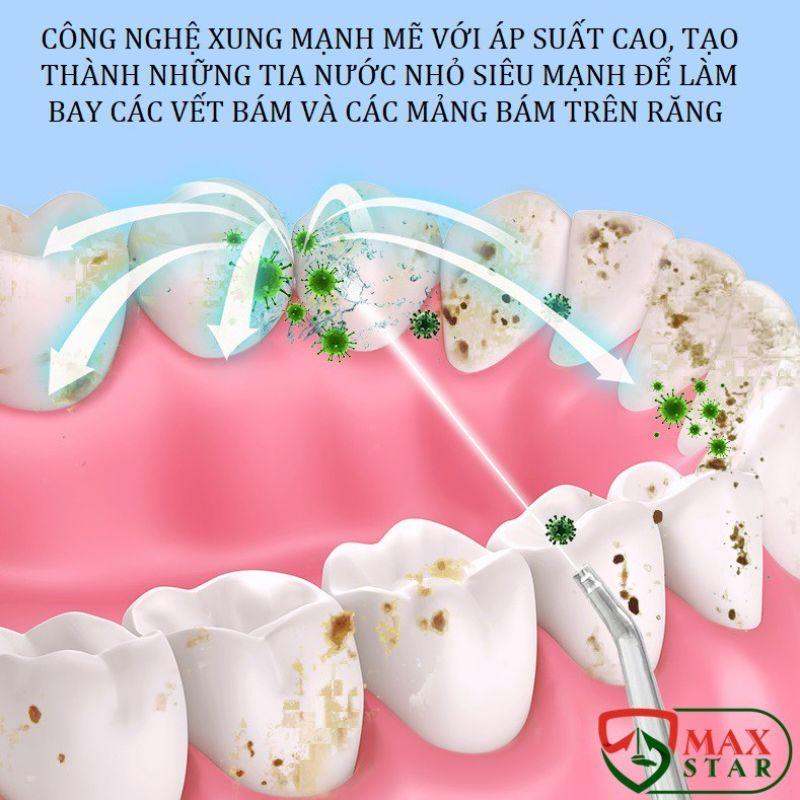 Máy Tăm Nước Cầm Tay - Tăm Nước Vệ Sinh Răng Miệng Oral Irrigator Bản Quốc Tế Chuẩn Châu Âu