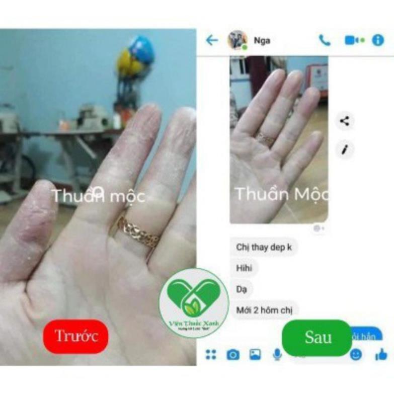 Cao Lá Thuần . Mộc Thanh Mộc . Hương - Kem Tri Rạn Da, Nứt Da