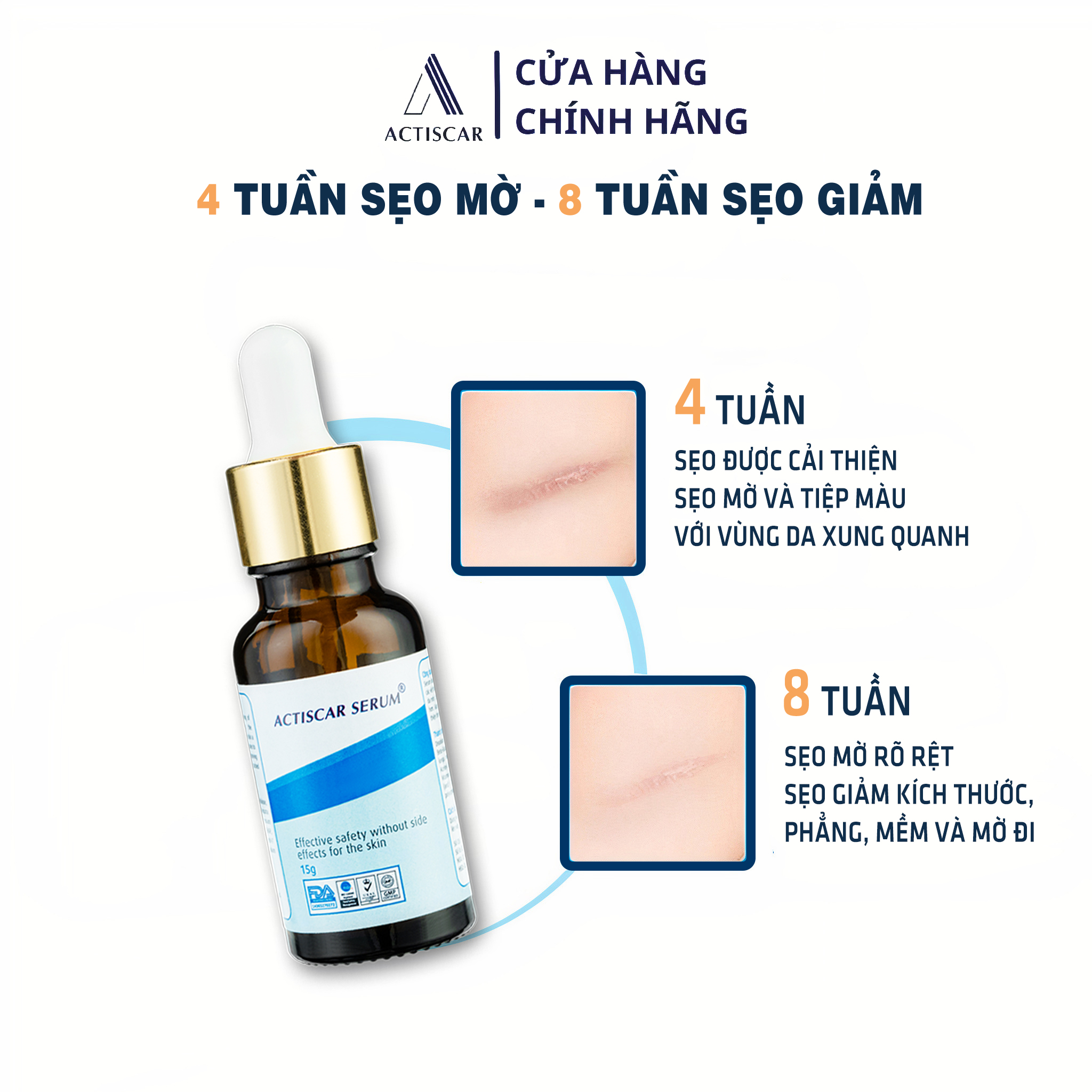 Serum xoá mờ sẹo Actiscar giảm sẹo lồi, sẹo rỗ và mờ thâm 15g