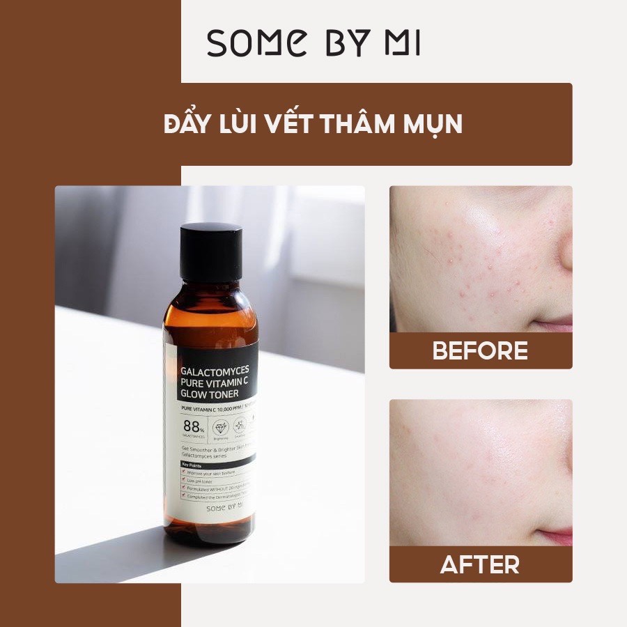 Nước Hoa Hồng Dưỡng Trắng, Chống Lão Hóa SomeByMi Galactomyces Pure Vitamin C Glow Toner 200ml