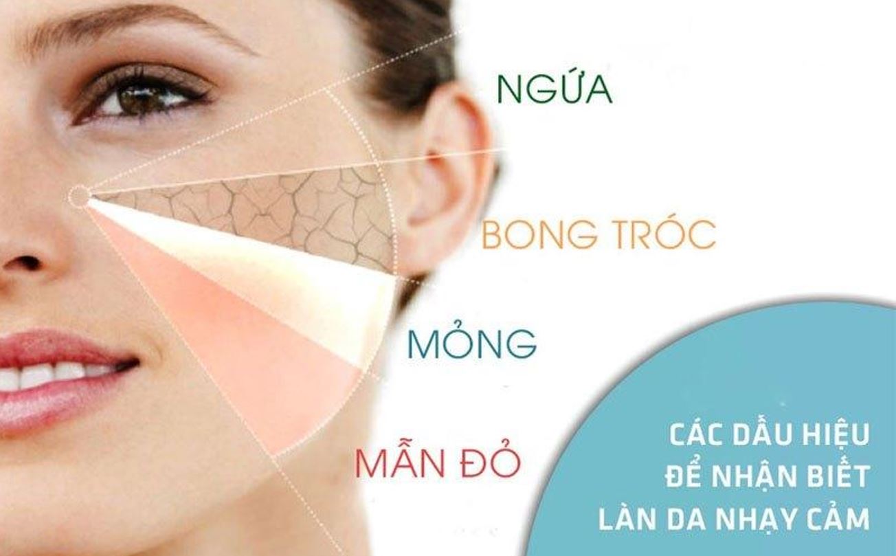 Kem Làm Dịu Da Bị Ửng Đỏ Apaisac Biorga Anti - Redness Soothing Cream