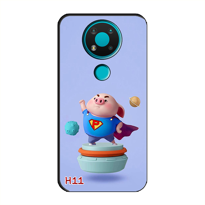 Ốp Dẻo Dành Cho NOKIA 3.4