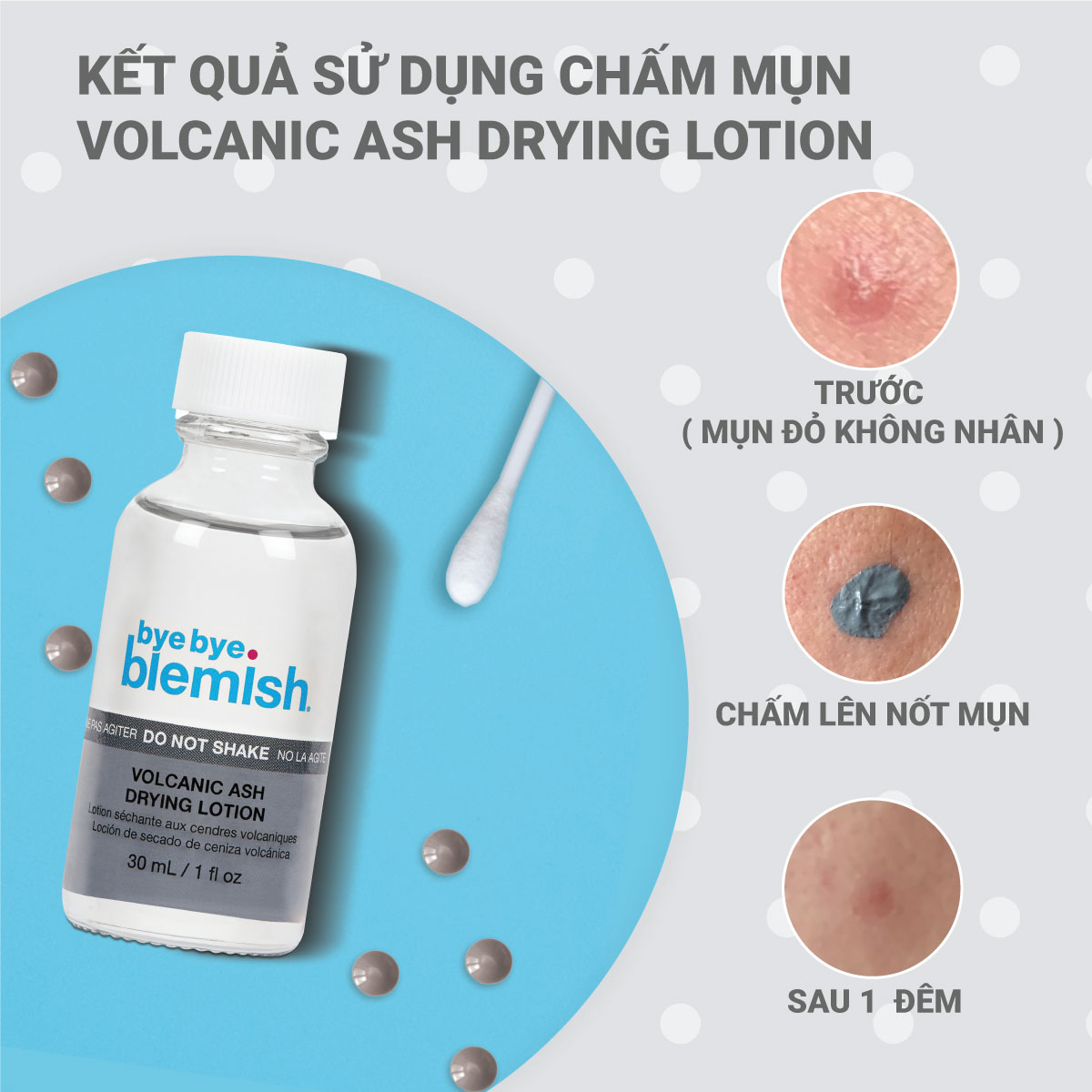 Chấm Mụn Tro Núi Lửa Giảm Mụn Nhanh Sau 1 Đêm Dành Cho Mụn Trắng, Sưng Đỏ Bye Bye Blemish Volcanic Ash Drying Lot