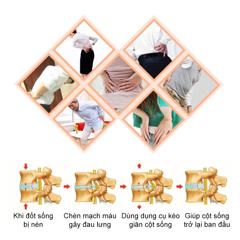 Dụng cụ kéo giãn cột sống cho người đau lưng, thoát vị đĩa đệm, thoái hóa cột sống rất tiện dụng