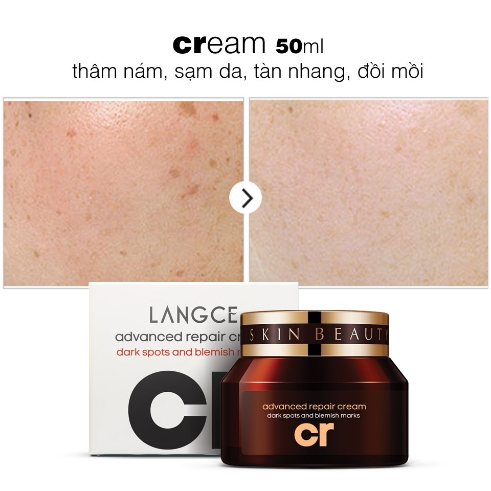 Cream Thâm Nám, Sạm Da, Tàn Nhang, Đồi Mồi 50ml TẶNG Kem Làm Rụng Lông Trắng Da 20ml LANGCE