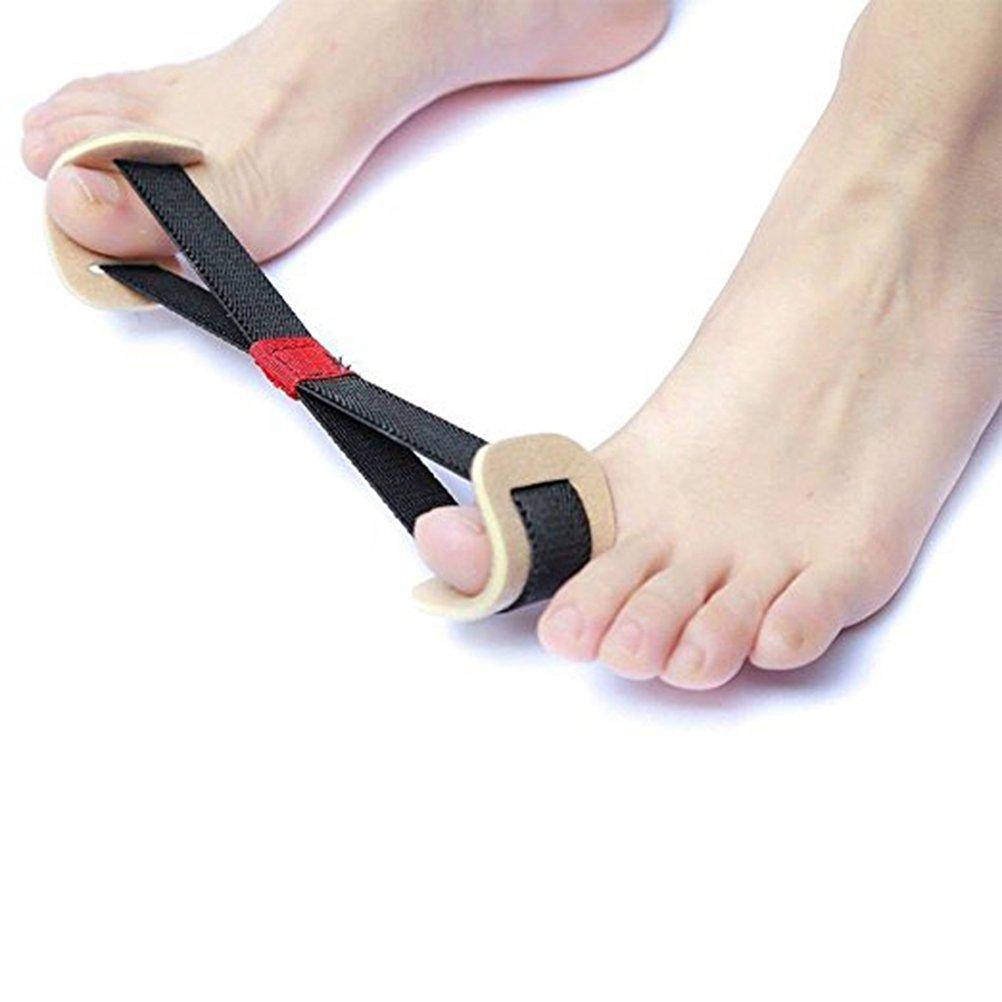Hallux valgus bunion búi ngón chân lớn