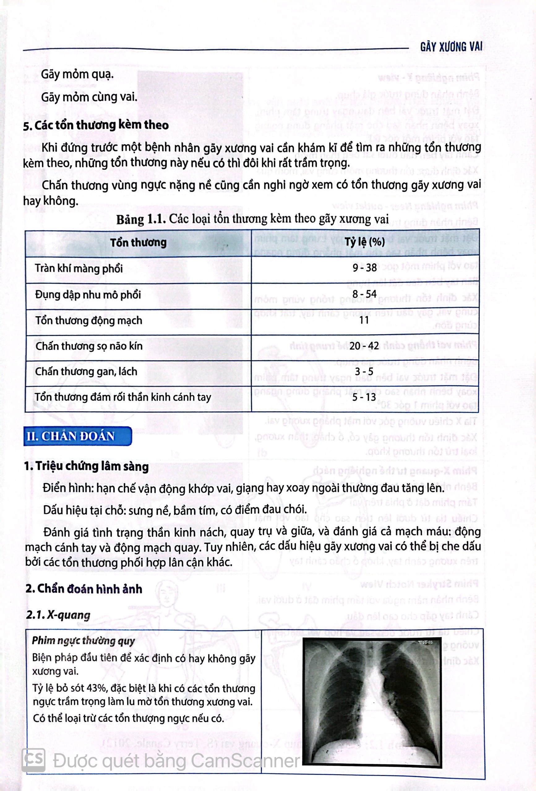 Benito - Sách - Chẩn đoán và ĐT gãy xương trật khớp chi trên - NXB Y học